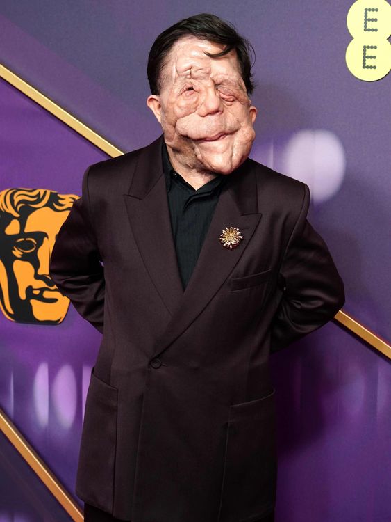 A Different Man star Adam Pearson at the 2025 BAFTA Film Awards. Pic: PA