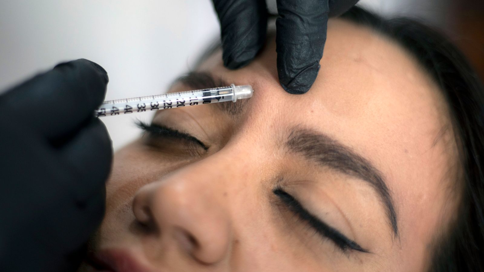 Scottish regulator warns against undergoing procedures at so-called Botox parties