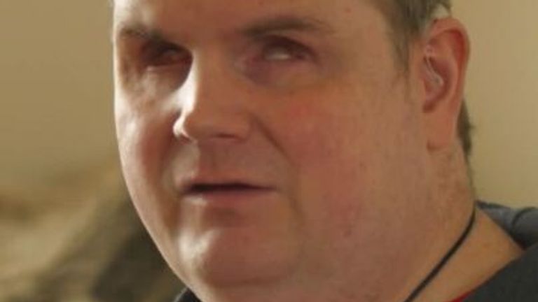 disabled blind man
