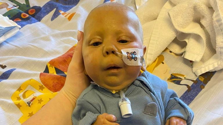 Three-month-old Charlie is receiving end of life care at Robin House Children's Hospice in Balloch. Pic: Family handout