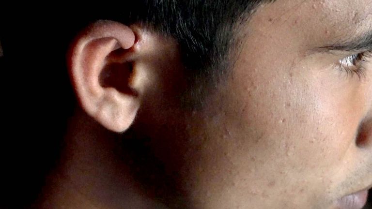 Rahmad alleges they beat him and slashed his ear: