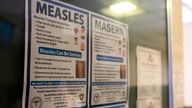 Signs inform people of measles prevention and testing at the Gaines County Court House in Seminole, Texas, U.S. April 6, 2025. Justin Rex for The Texas Tribune via REUTERS NO RESALES. NO ARCHIVES. MANDATORY CREDIT. THIS IMAGE HAS BEEN SUPPLIED BY A THIRD PARTY
