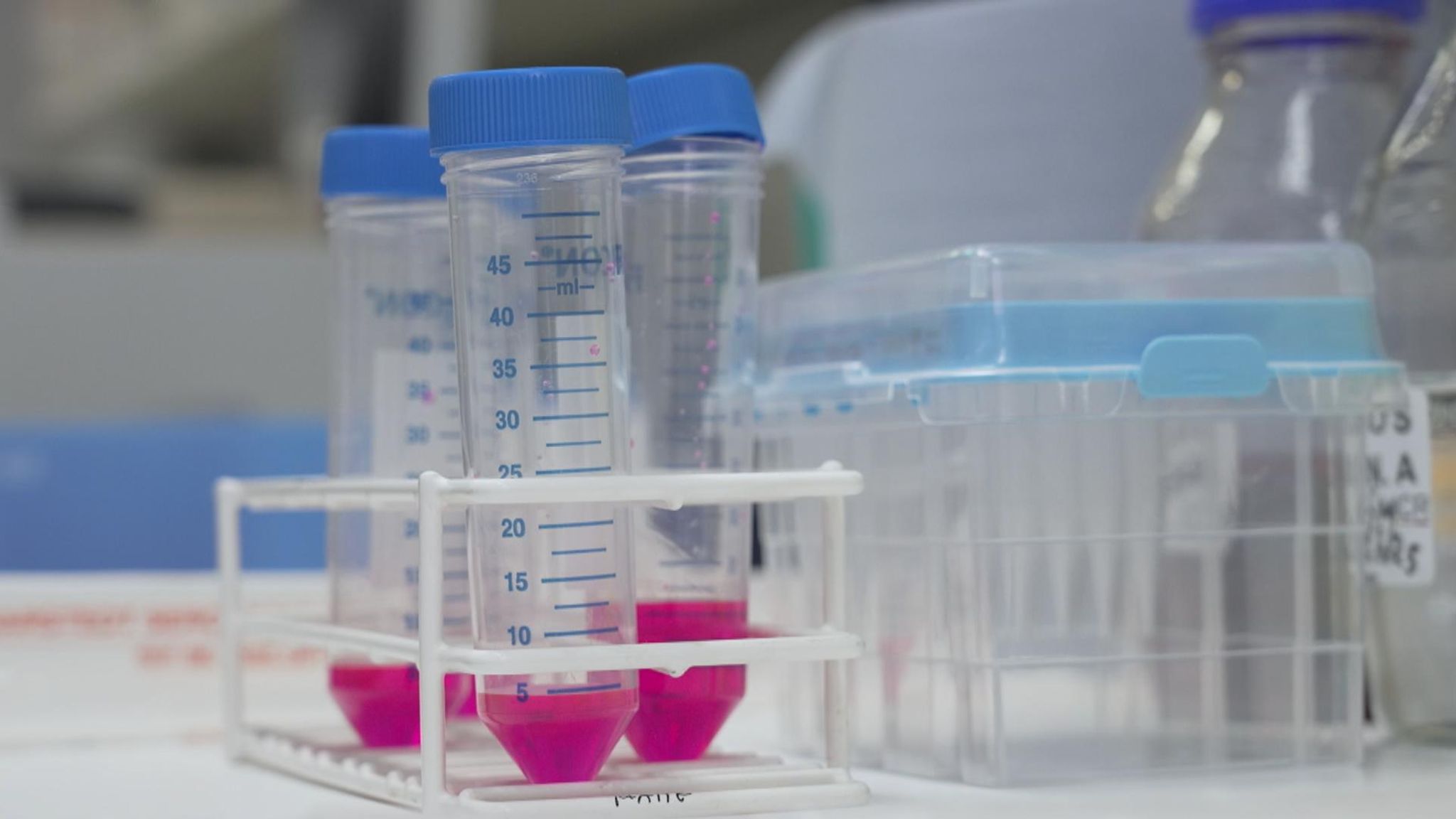 Gamechanging Breast Cancer Pill Offers New Hope and Precious Time