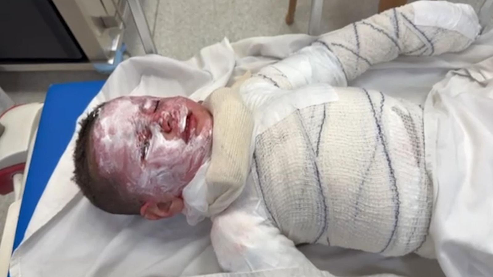 'What did they do to be burned and bombed?': Charity calls on UK to offer Gaza children life-saving treatment