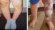 Finias Sandu's surgery pictures