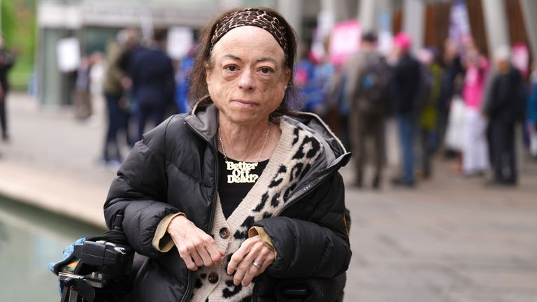 Oyuncu Liz Carr, tartışma ve yardımlı ölüme oy vermeden önce Edinburgh'daki İskoç Parlamentosu dışındaki medyayla konuşuyor.  Pic: PA
