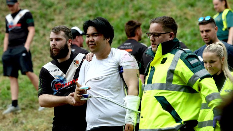 An injured antheral   is escorted aft  competing successful  the yearly  Cooper's Hill Cheese-Rolling and Wake contention  adjacent   Brockworth, Britain May 26, 2025. REUTERS/Isabel Infantes