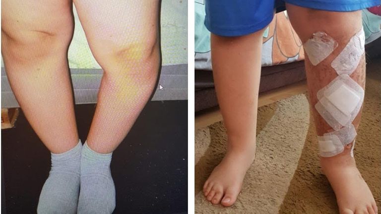 Finias Sandu's surgery pictures