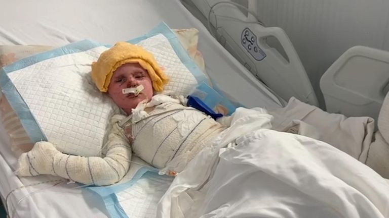 Hatem, aged three, in a hospital bed in Gaza 
