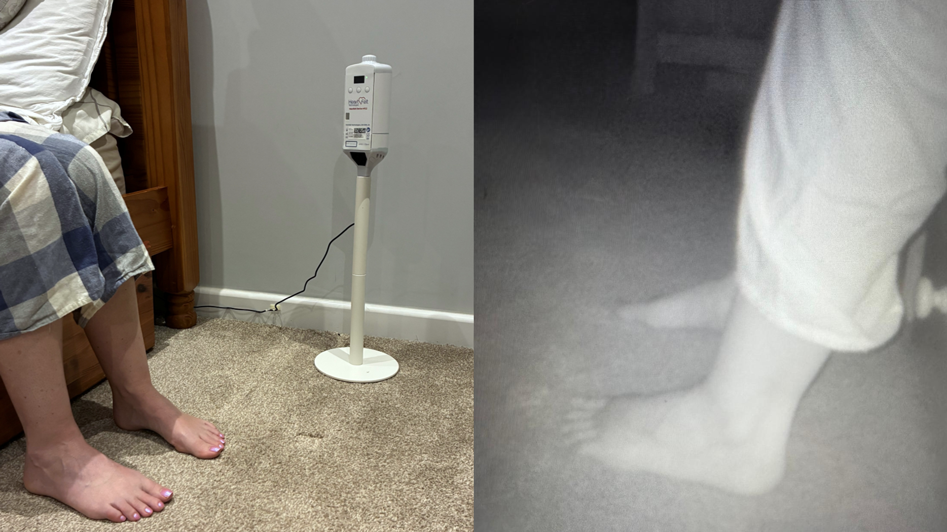 AI foot scanner recognises warning signs of heart failure to keep people out of hospital, researchers say