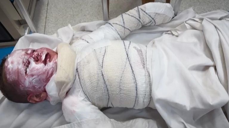 Haitum, a three-year-old Palestinian being treated by Dr Victoria Rose