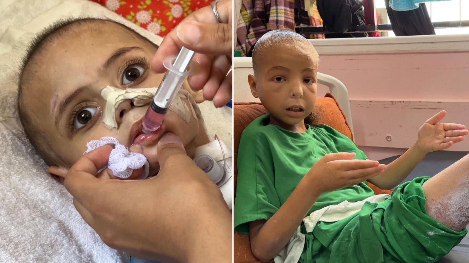 Inside Gaza's Nasser Hospital - where there's virtually no food for malnourished children