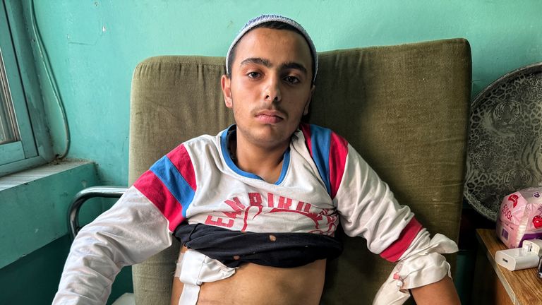 A young man in the hospital
