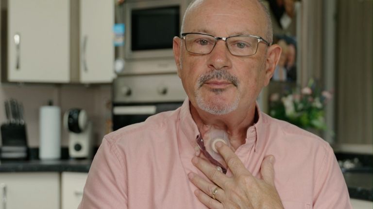'My voice box was removed after NHS missed my throat cancer'