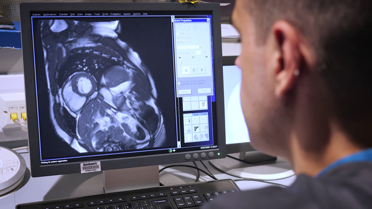 MRI-scans en een technicus van het UK Biobank-project
