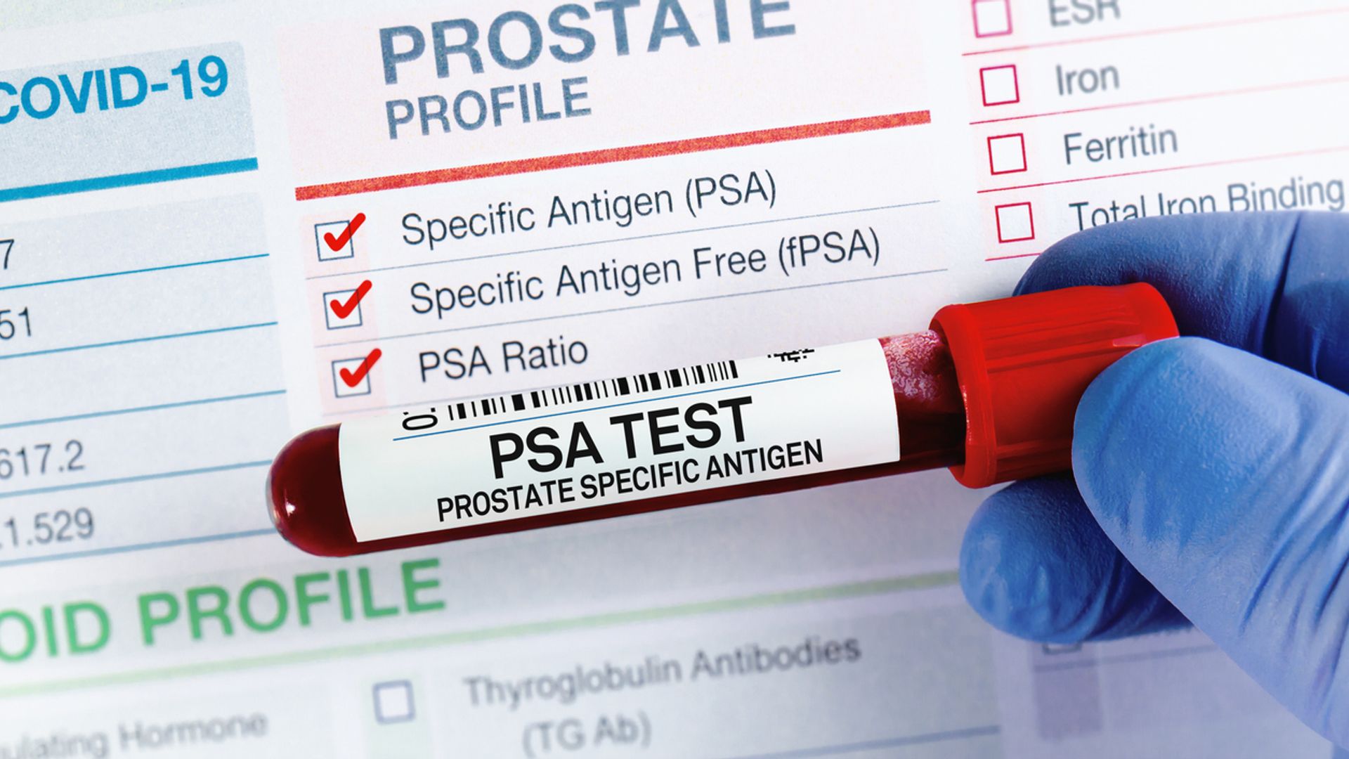 Prostate cancer cases surge in UK - as charity warns against 'myths'