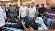 Photographer Hatem Khaled, a Reuters contractor, wounded after strike on Nasser hospital. Pic: Reuters