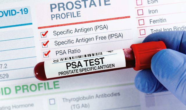 Prostate cancer: NHS screening programme could come one step closer today