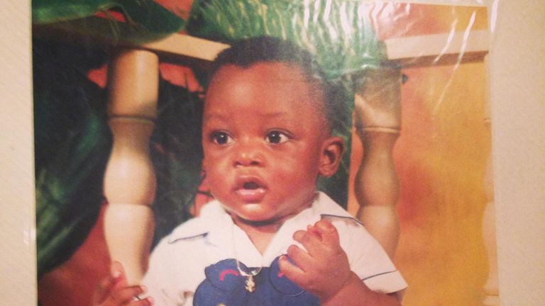 Romeo was just one when an accident left him with burns on his chest, neck and stomach