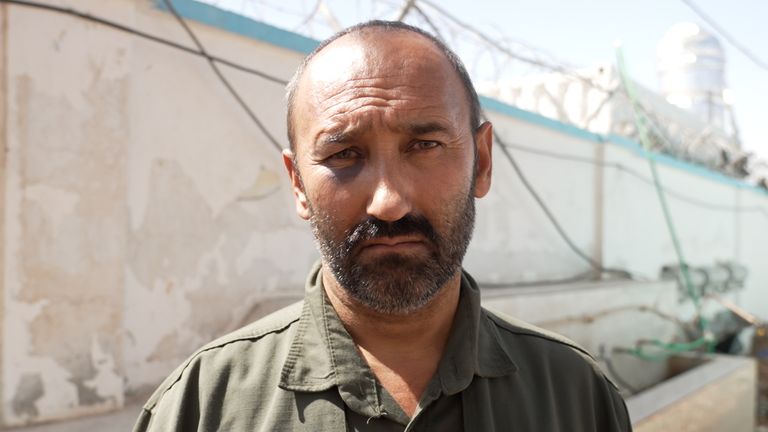 Gholam Ali shows us his black eye, which he says Iranian police gave him