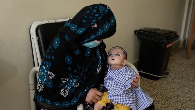 A baby looks up at her mother at Badakhshan Provincial Hospital 