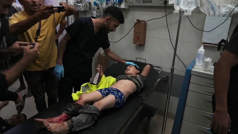 Children were injured and some were killed in Sunday's strikes, local health officials say. Pic: AP