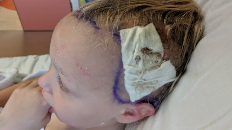 Rosie-May in hospital 