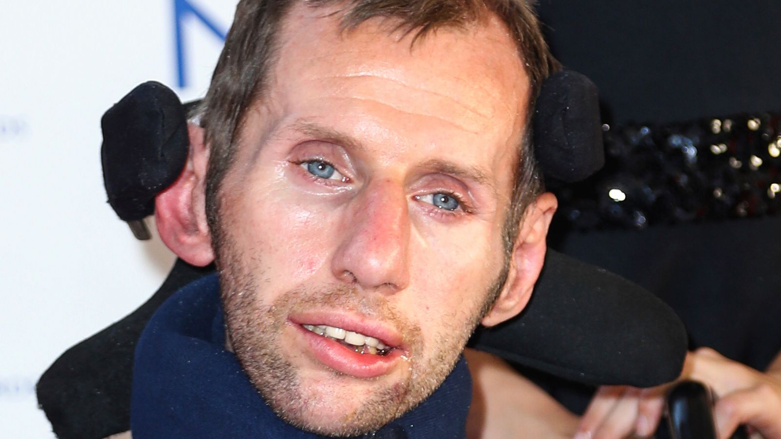 Drug breakthrough could 'substantially slow progression' of motor neurone disease