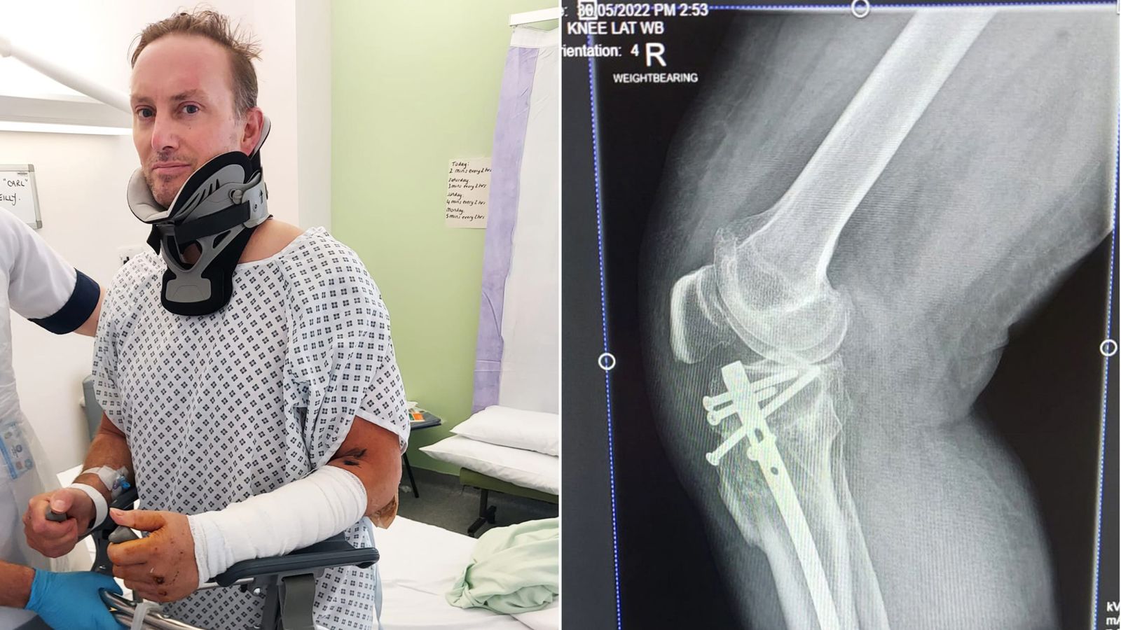 Worst areas for uninsured driving revealed - as hit-and-run victim says he was 'left for dead'