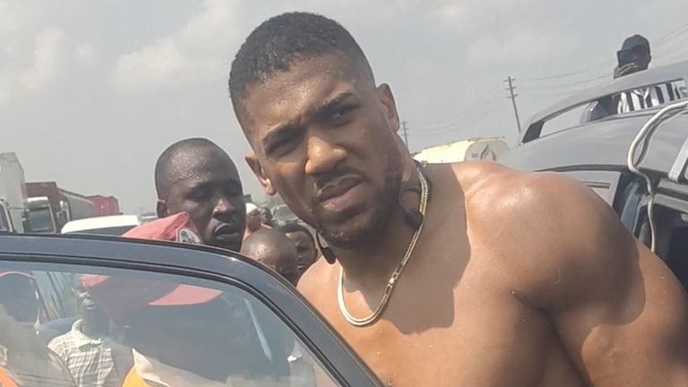 Anthony Joshua kaza sonrası hastaneye kaldırıldı