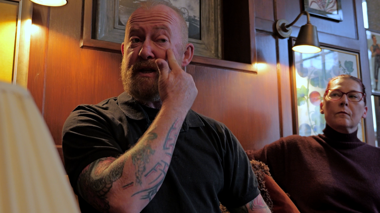 O veterano da RAF Pete Lewis mostra as cicatrizes da câmera em seu rosto.