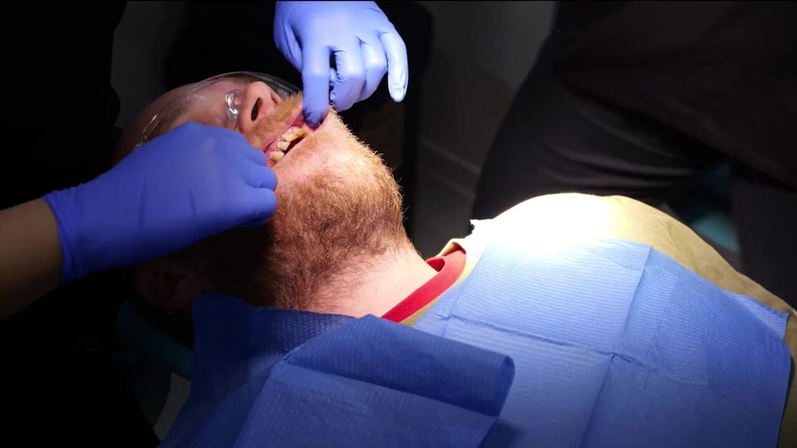 DIY dentistry and no check-ups: How a health crisis is hurting Britons ...