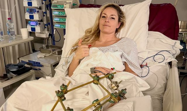 Team USA skier Lindsey Vonn 'discharged from hospital' a week after horror Olympics crash