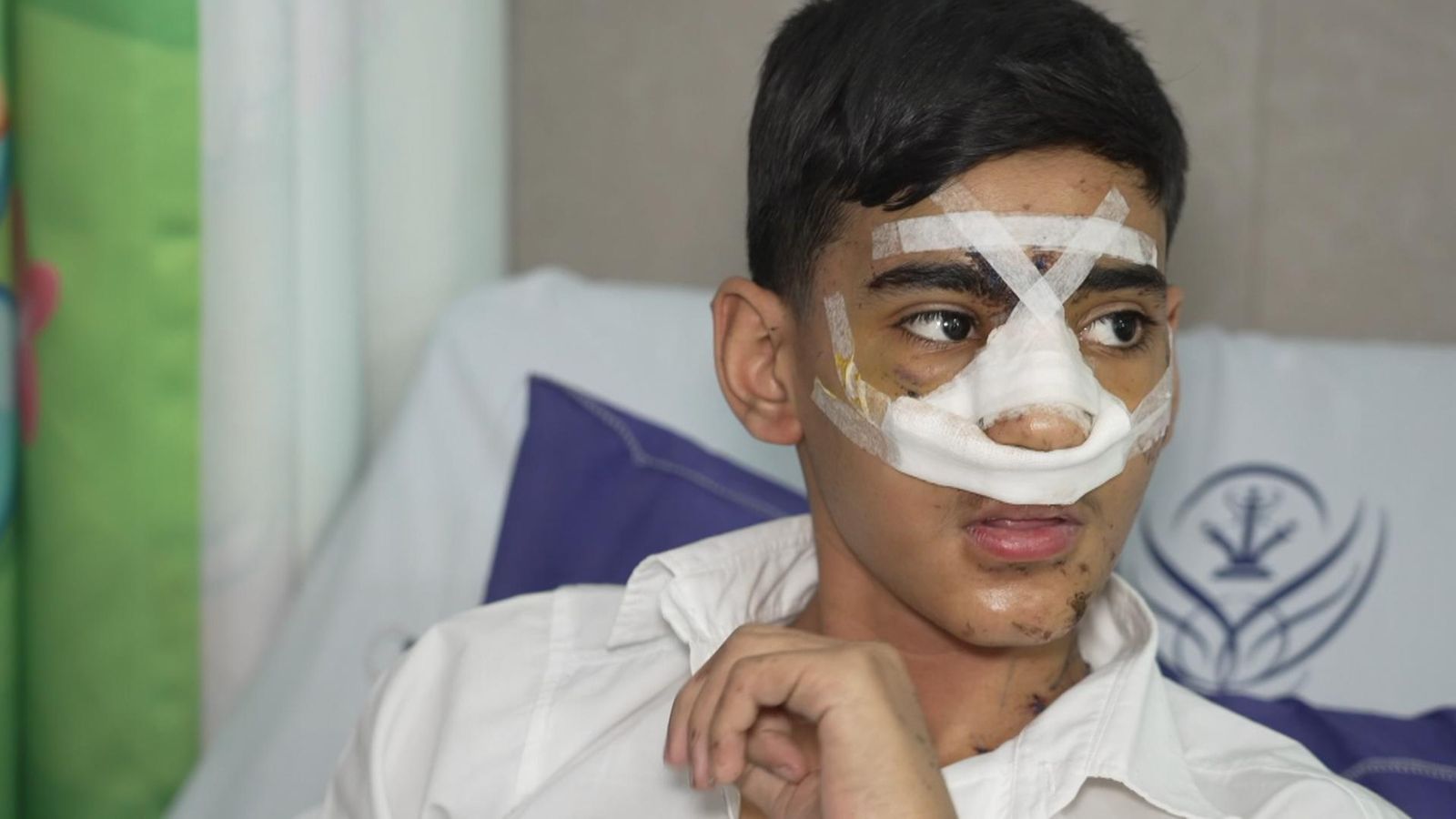 Inside Iran’s children’s wards: The painful human cost of US-Israel airstrikes