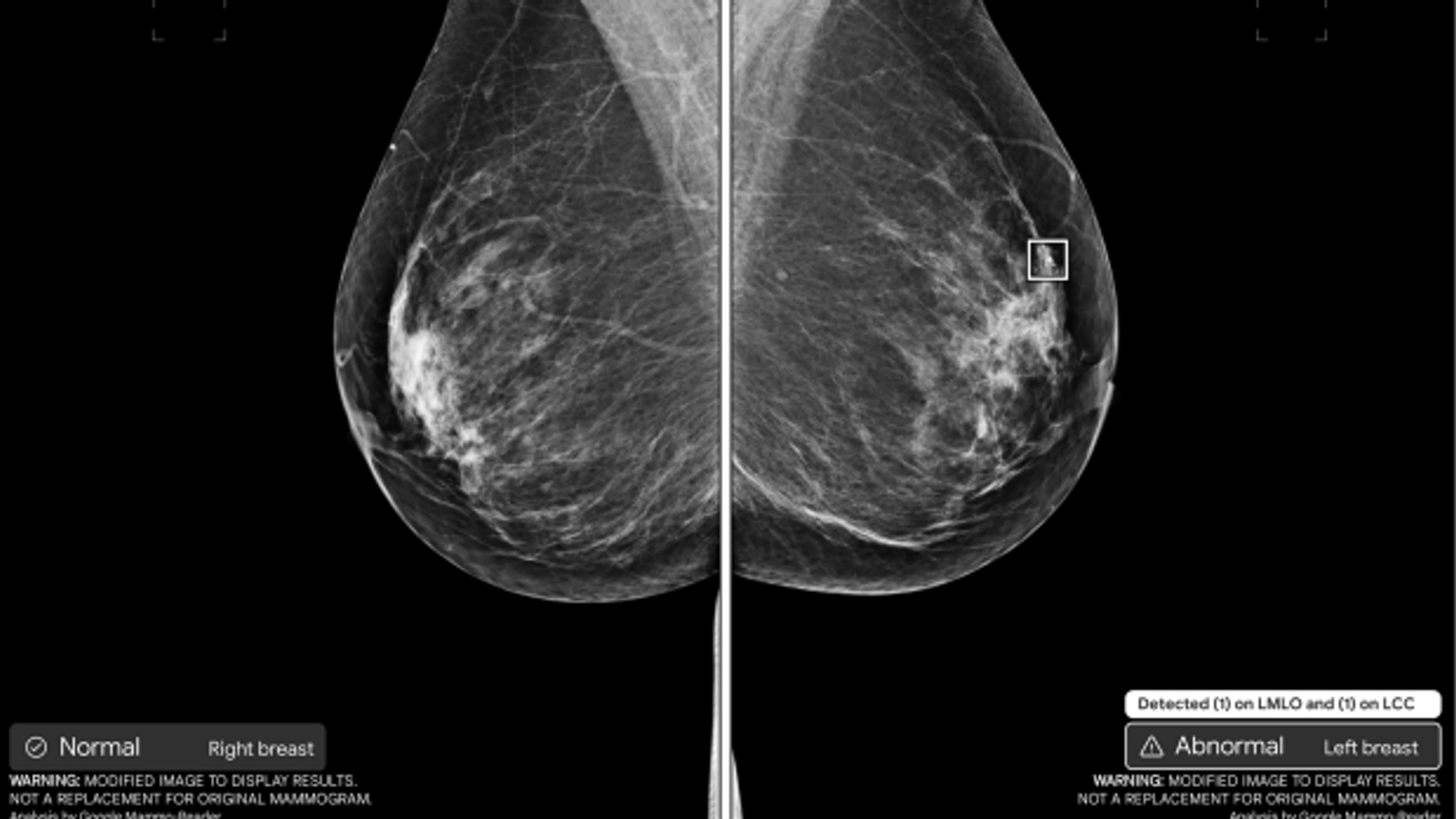 Why NHS needs time to bring in lightning speed cancer checks | Science ...