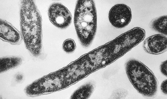 UK health agency investigating London Legionnaires' disease cluster