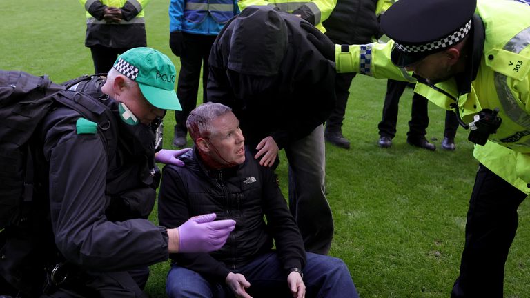 An injured man receives medical attention on the pitch. Pic: PA