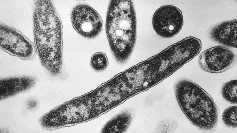 UKHSA Investigates Legionnaires' Disease Cluster in London