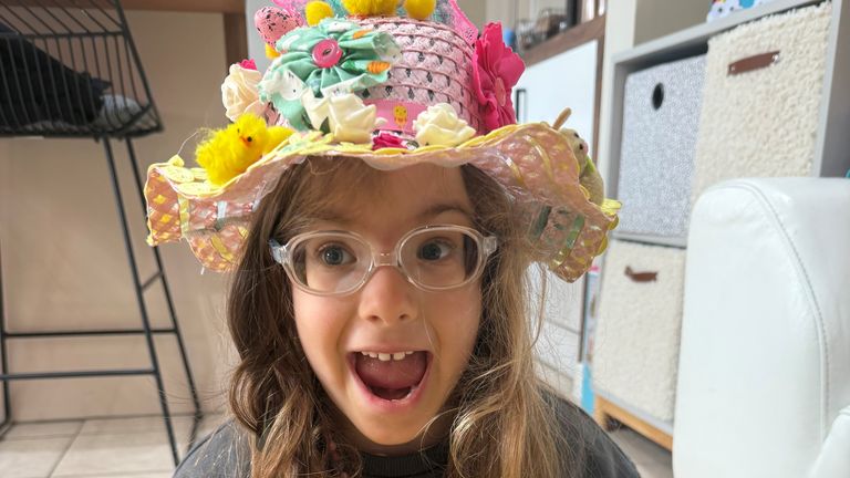 Saffie underwent eye gene therapy in April last year. Pic: Great Ormond Street Hospital