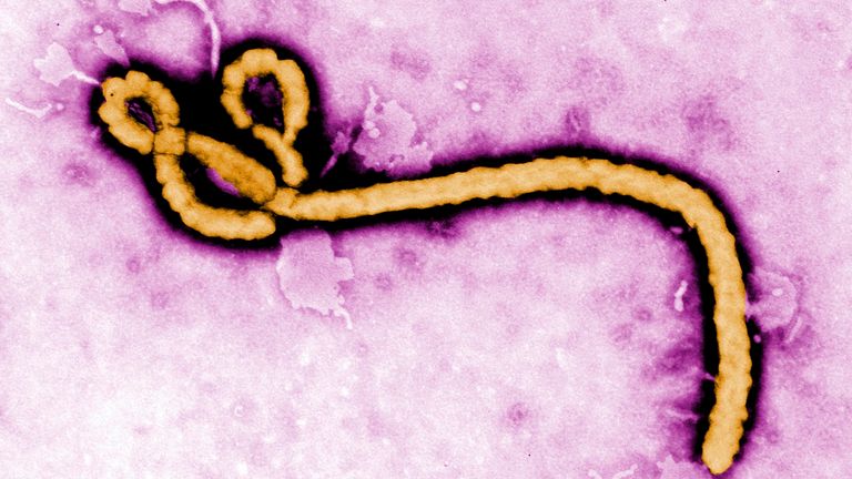 An Ebola virus virion. Pic: Reuters 
