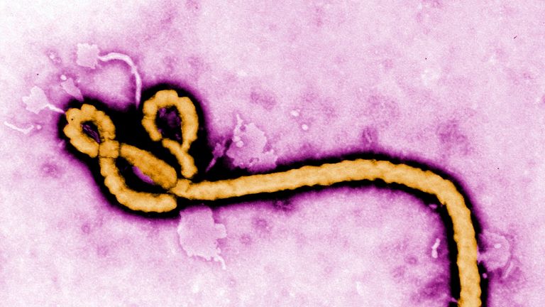Ebola latest: WHO worried about 'scale and speed' of outbreak