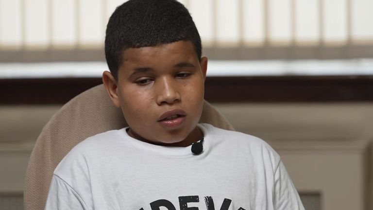 Mahmoud has had  to have a kidney removed 