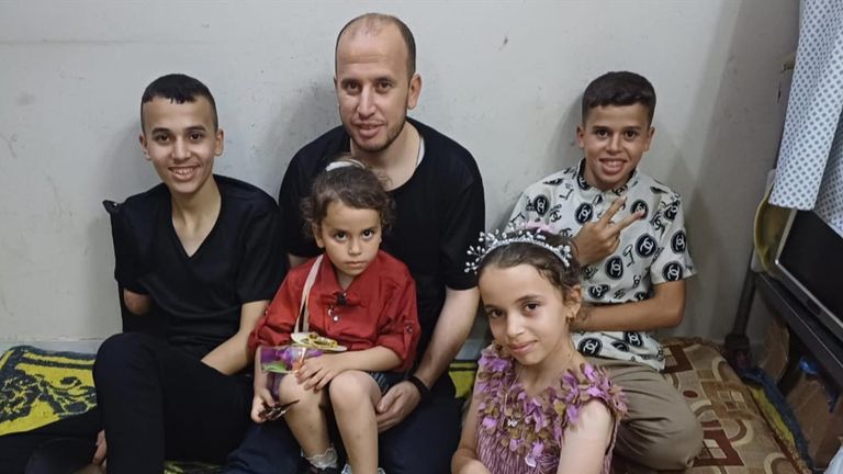 The 15-year-old wishes his dad could support him through the operations he needs