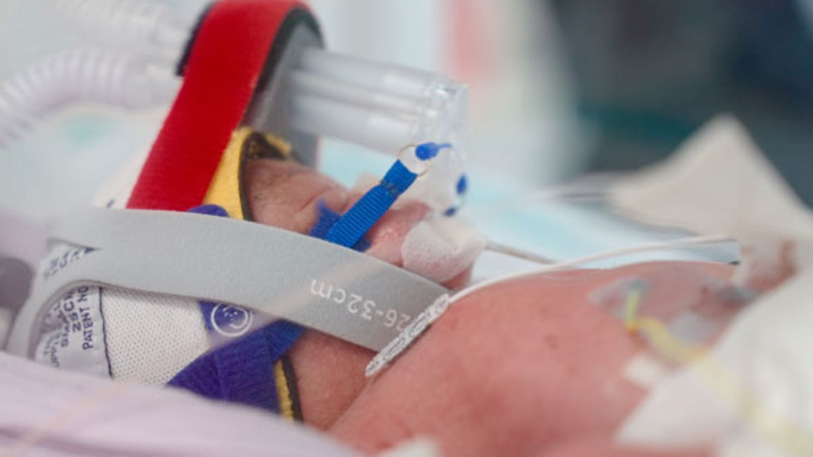 ‘Four precious miracles’: Identical quadruplets born in Australia in a one in 15 million chance | World News