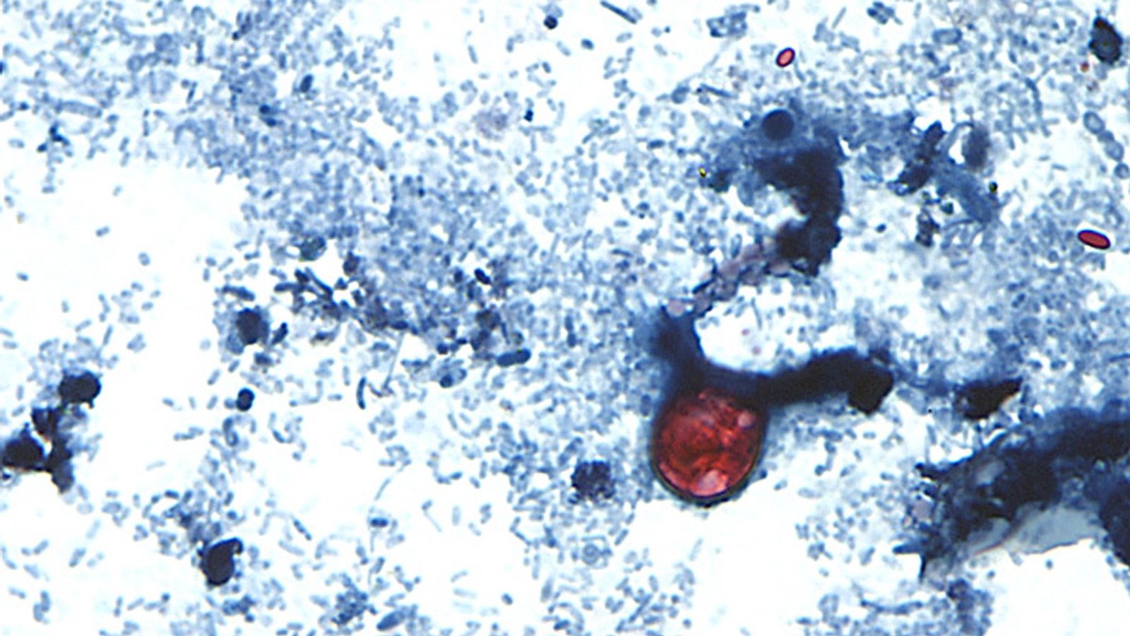 Two Dead as Cyclospora Outbreak Hits Michigan - News Directory 3