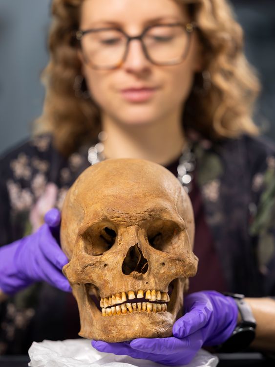 Dr Jess Thompson examining the skull. Pic: NMS/PA