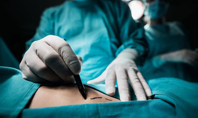 Bottom Surgery 'Cosmetic cowboys' to face fines if they carry out risky procedures ...